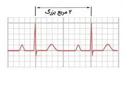 تعیین ریت نوار قلب